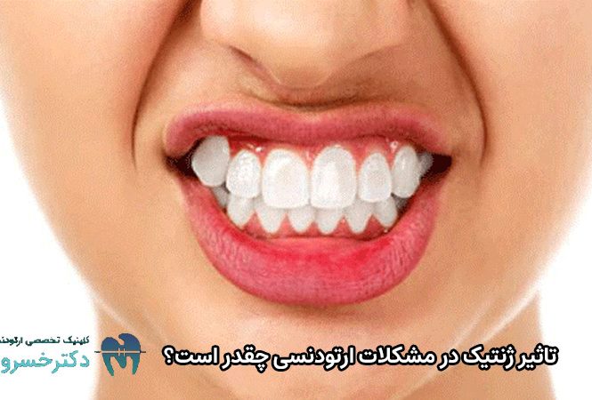 تاثیر ژنتیک در مشکلات ارتودنسی