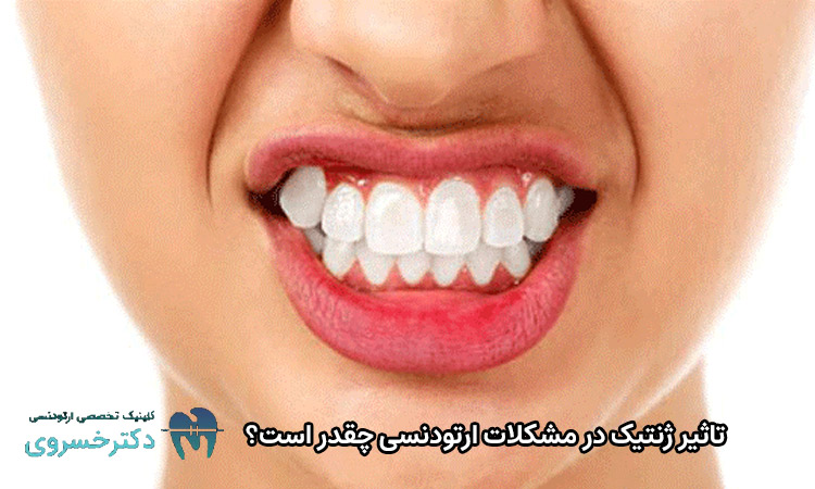 تاثیر ژنتیک در مشکلات ارتودنسی