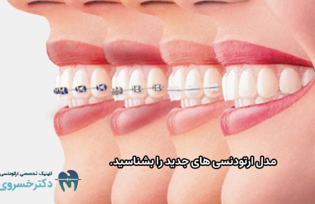 مدل ارتودنسی های جدید