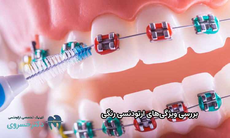 بررسی ویژگیهای ارتودنسی رنگی