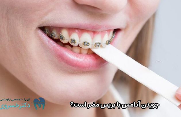 ضرر جویدن آدامس با بریس