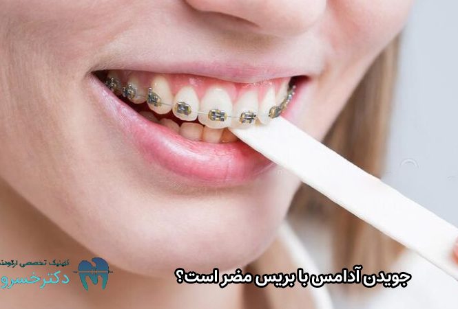 ضرر جویدن آدامس با بریس