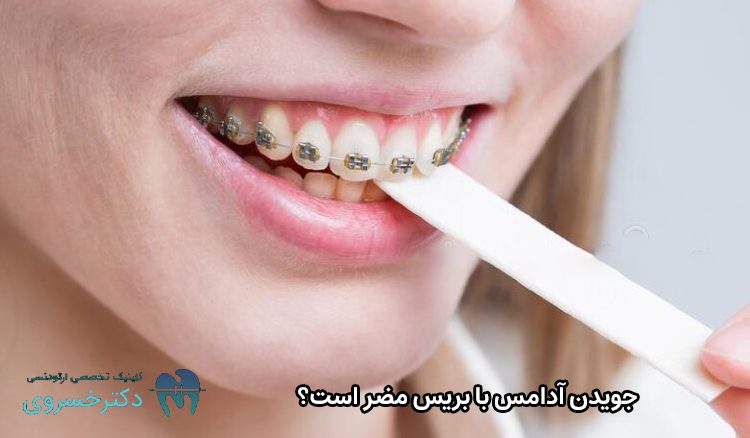 ضرر جویدن آدامس با بریس