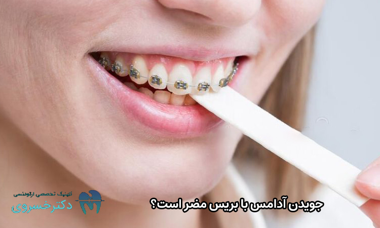 ضرر جویدن آدامس با بریس