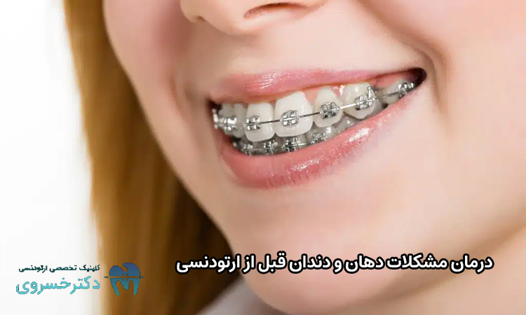 درمان مشکلات دندان قبل از ارتودنسی