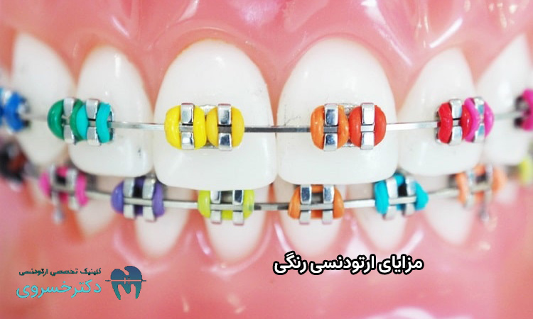 مزایای ارتودنسی رنگی