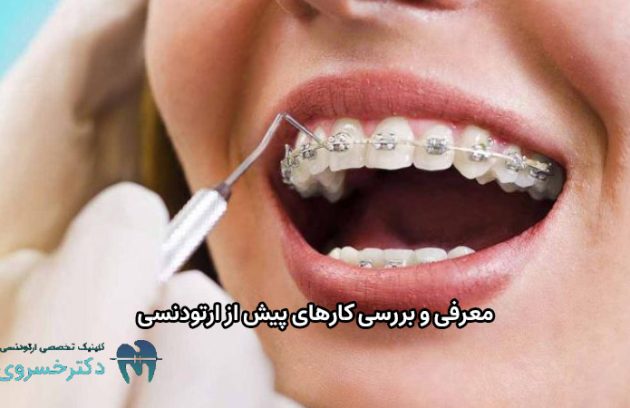 کارهای پیش از ارتودنسی