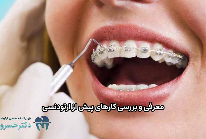 کارهای پیش از ارتودنسی