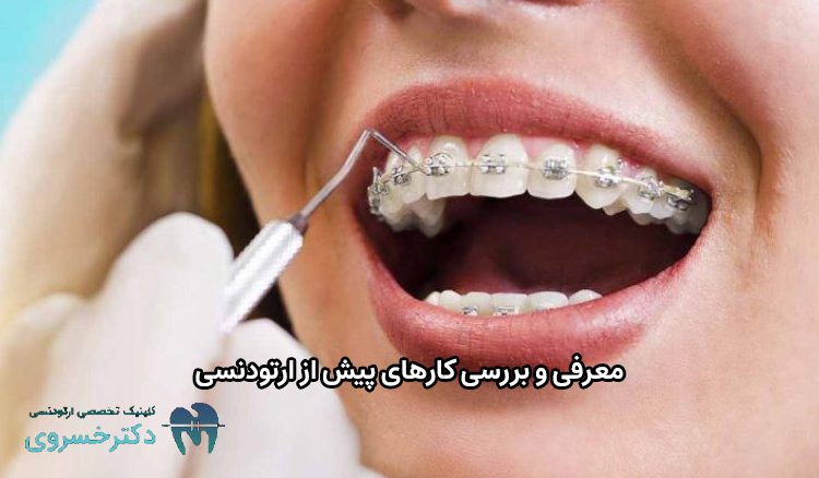 کارهای پیش از ارتودنسی