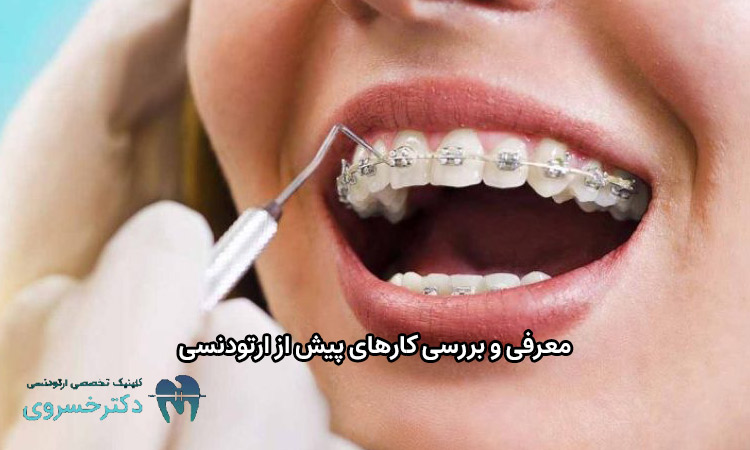 کارهای پیش از ارتودنسی