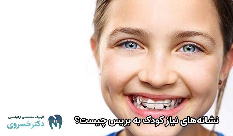 نشانه‌های نیاز کودک به بریس