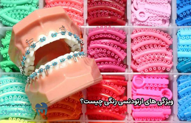 ویژگی های ارتودنسی رنگی