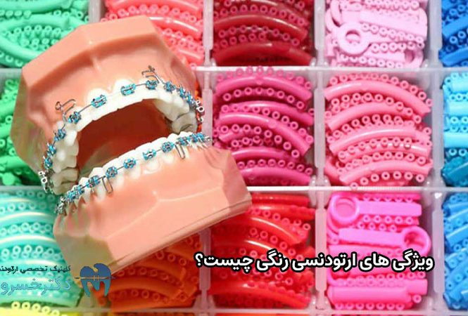 ویژگی های ارتودنسی رنگی