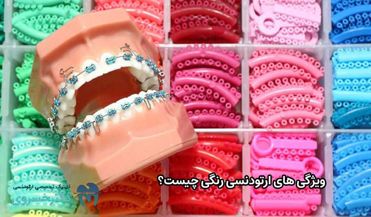ویژگی های ارتودنسی رنگی