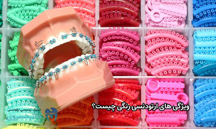 ویژگی های ارتودنسی رنگی