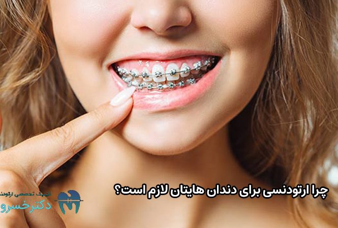 چرایی ارتودنسی دندان