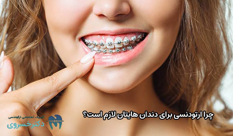چرایی ارتودنسی دندان
