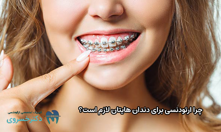 چرایی ارتودنسی دندان