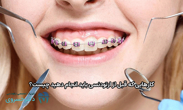 کارهای قبل از ارتودنسی دندان
