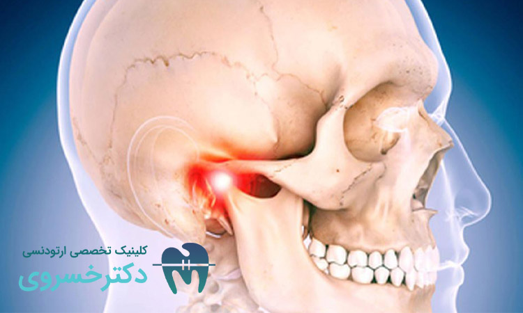 صدای مفصل فک