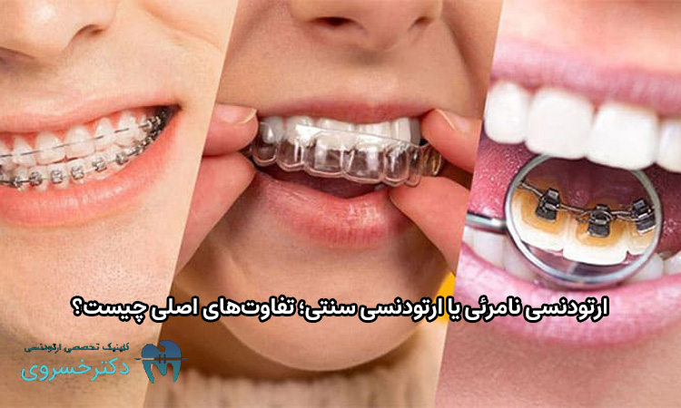 فرق ارتودنسی نامرئی یا ارتودنسی سنتی