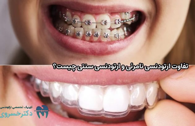 تفاوت ارتودنسی نامرئی و ارتودنسی سنتی