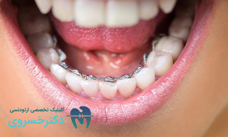 تکامل فناوریهای نوین ارتودنسی