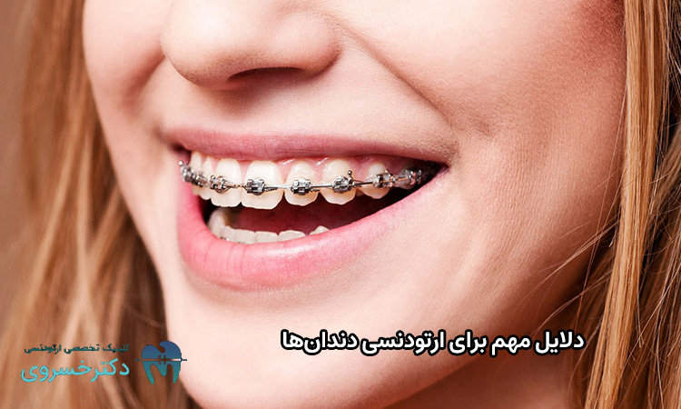 دلایل مهم برای ارتودنسی دندانها