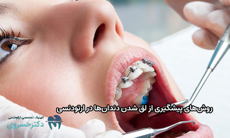 پیشگیری از لق شدن دندانها در ارتودنسی