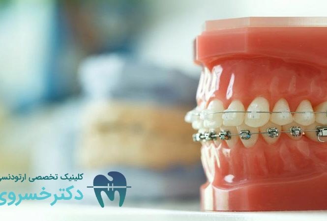 روند تکامل درمان‌های ارتودنسی