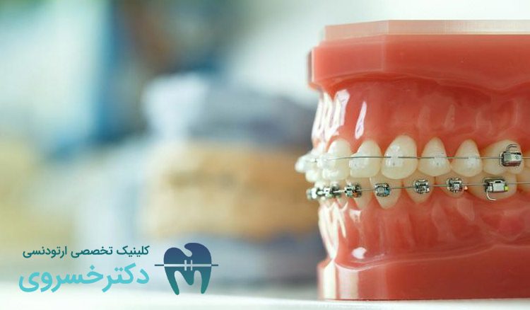 روند تکامل درمانهای ارتودنسی