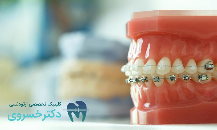 روند تکامل درمان‌های ارتودنسی