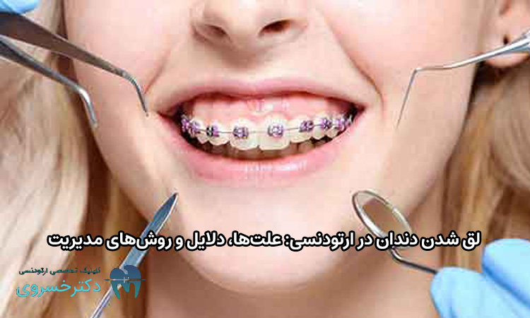 لق شدن دندان در ارتودنسی