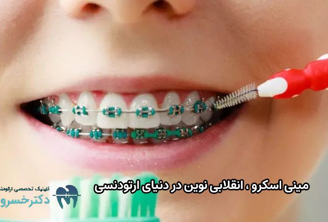 مینی اسکرو