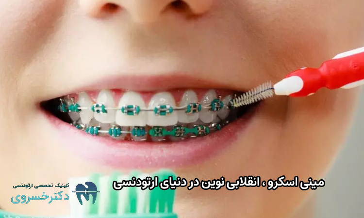 مینی اسکرو