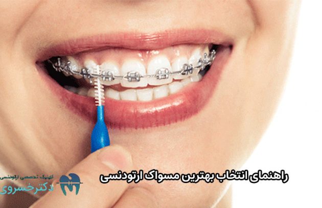 انتخاب بهترین مسواک ارتودنسی