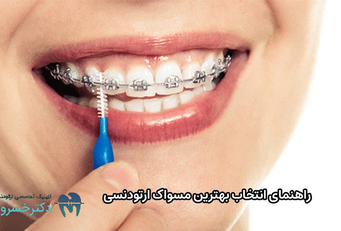 انتخاب بهترین مسواک ارتودنسی
