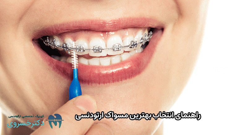 انتخاب بهترین مسواک ارتودنسی