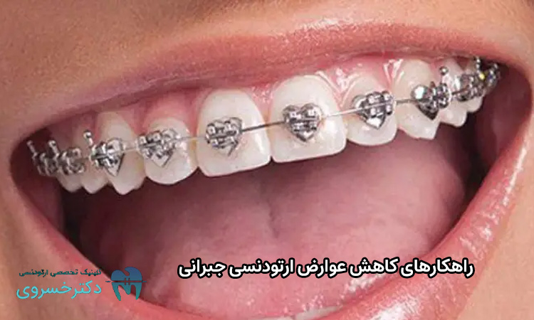 کاهش عوارض ارتودنسی جبرانی