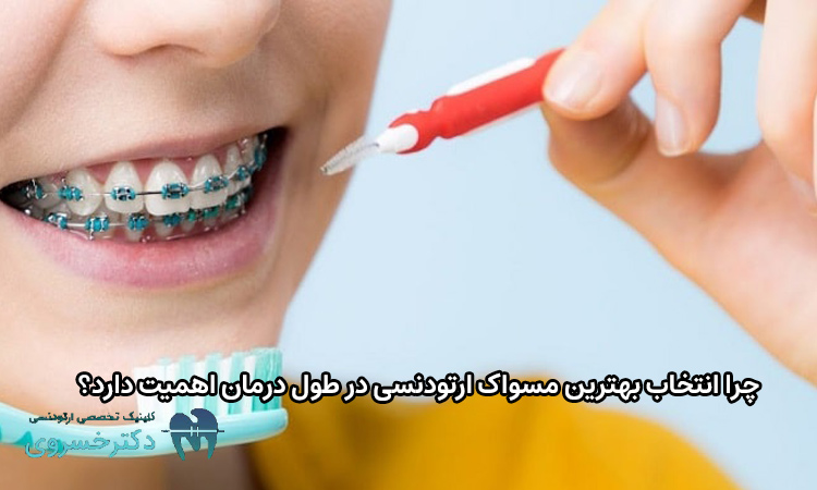 اهمیت انتخاب بهترین مسواک ارتودنسی