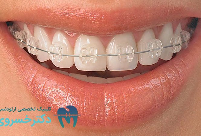 ارتودنسی دندان مناسب چه کسانی است؟