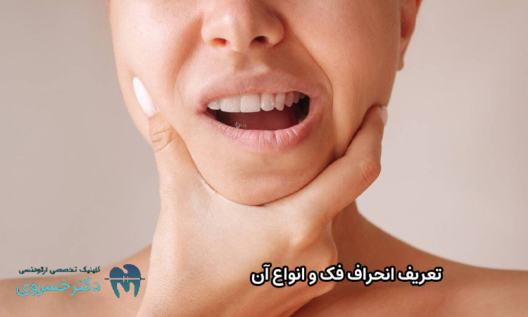 تعریف انحراف فک
