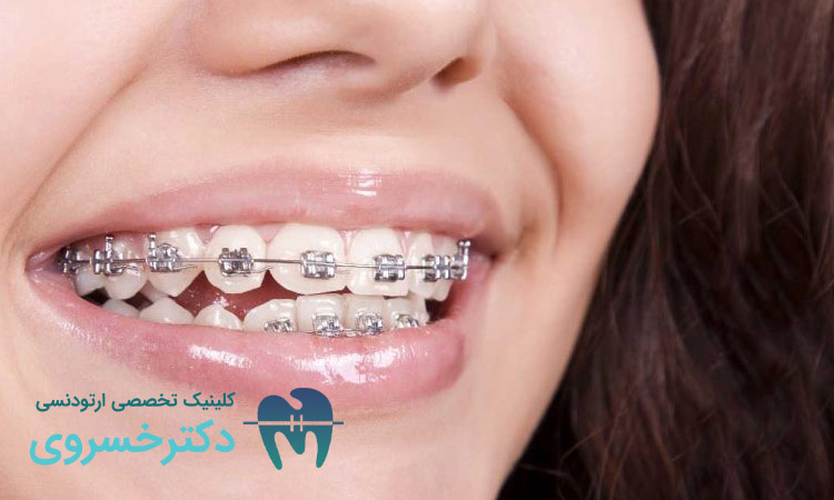 علل انجام ارتودنسی مجدد