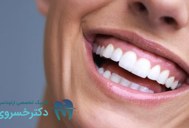 روش درمان لبخند لثه‌ ای