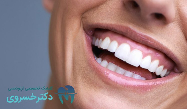 روش درمان لبخند لثه‌ ای