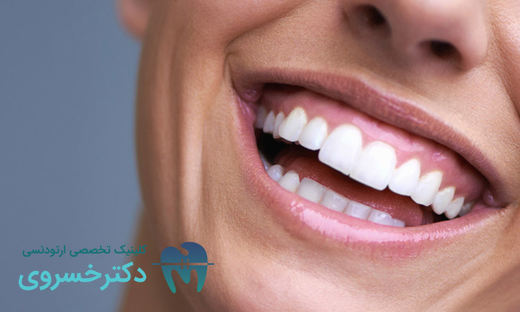روش درمان لبخند لثه‌ ای