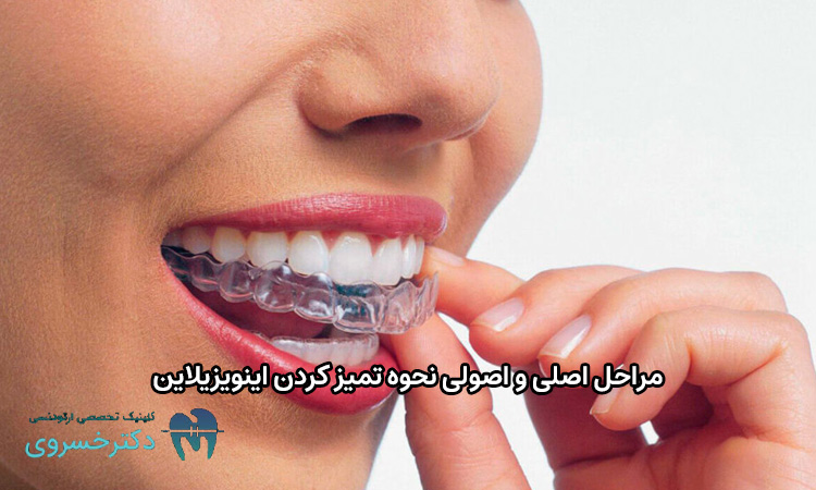 مراحل نحوه تمیز کردن اینویزیلاین