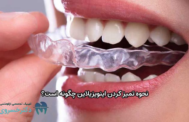 نحوه تمیز کردن اینویزیلاین