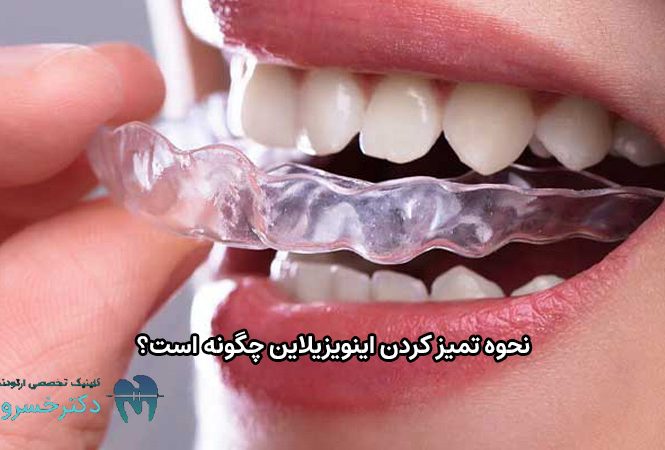 نحوه تمیز کردن اینویزیلاین