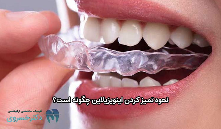 نحوه تمیز کردن اینویزیلاین